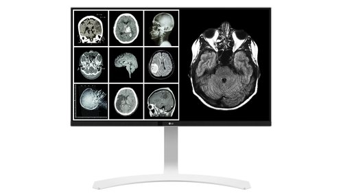 Grosbill Ecran PC LG 27HJ712C-W/27" DICOM IEC60601